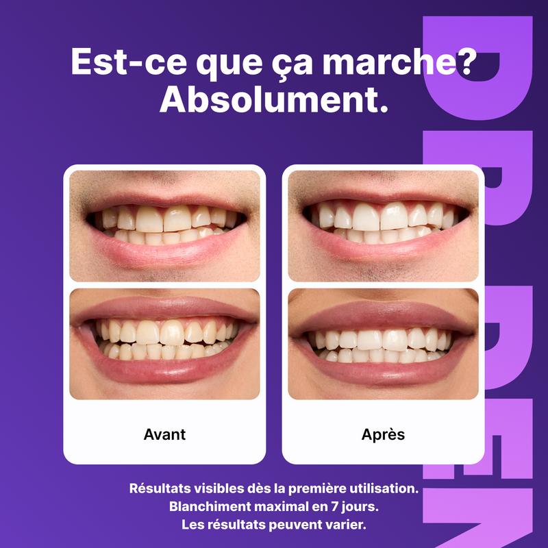 DRDENT Bandes blanchissantes pour les dents violettes – 7/21 applications de blanchiment – Douces pour l’émail – Convient aux dents sensibles – Sans peroxyde — vignette 2