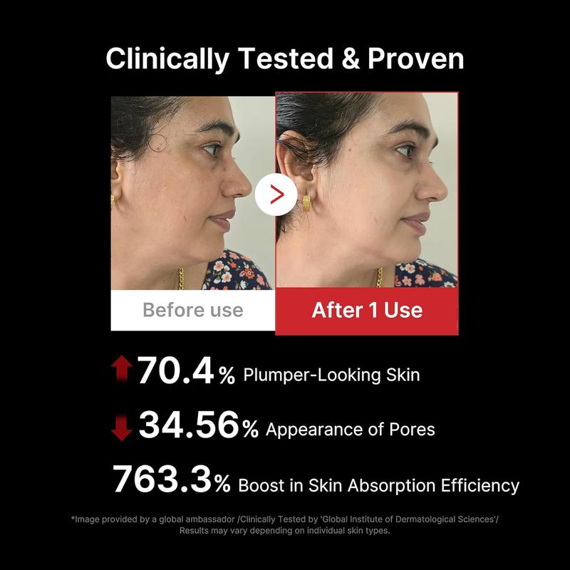 [medicube] AGE-R Booster Pro - Noir | Appareil viral de la beauté coréenne effet verre lumineux pour une peau éclatante et le confort du visage — vignette 4