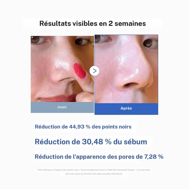 [medicube Officiel] Zero Pore Pad (AHA+BHA) | Soin Tonique pour une Peau Lisse — vignette 5
