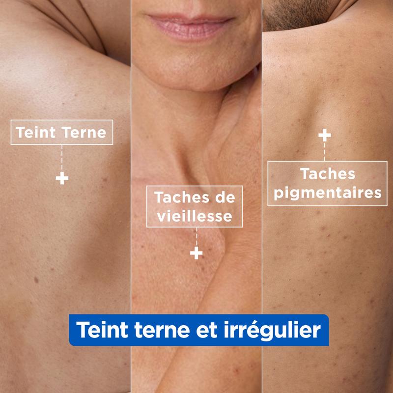 Routine Anti-taches Niacinamide - Adaptée au Visage, Corps et Mains - Mixa — vignette 2