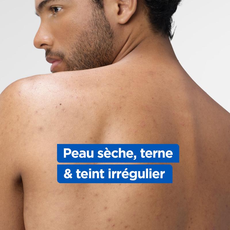 Routine Anti-taches Niacinamide - Adaptée au Visage, Corps et Mains - Mixa — vignette 7