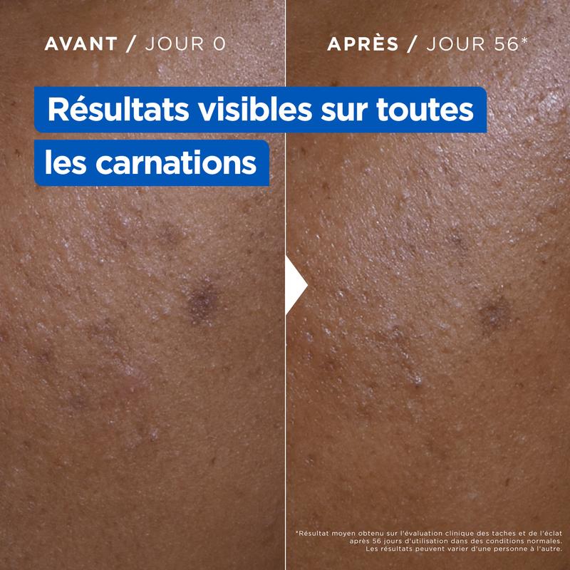 Routine Anti-taches Niacinamide - Adaptée au Visage, Corps et Mains - Mixa — vignette 8