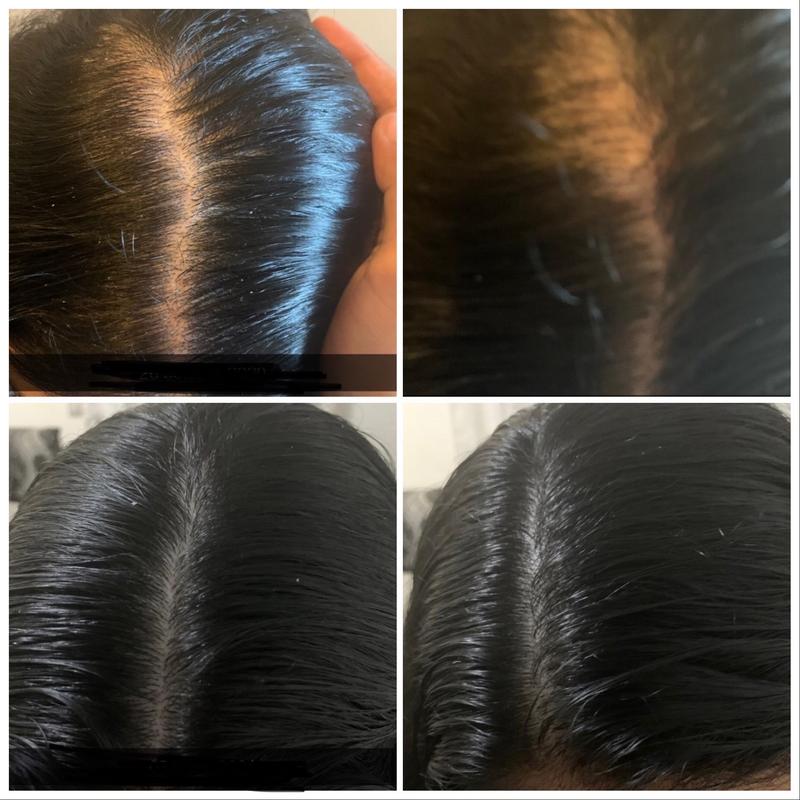Syra Huile Miracle Réparation Nourrissante En Profondeur pour Cheveux Doux et Brillants — vignette 2