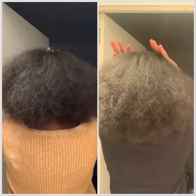 Syra Huile Miracle Réparation Nourrissante En Profondeur pour Cheveux Doux et Brillants — vignette 5
